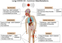 Informacion mbi sëmundjen post-Covid-19